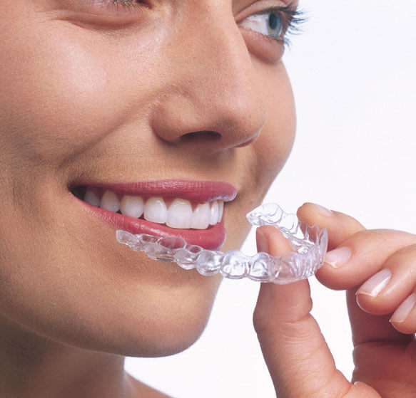 Invisalign