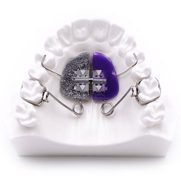 Rapid maxillary expanders